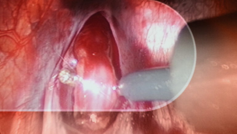 anesthesia4
