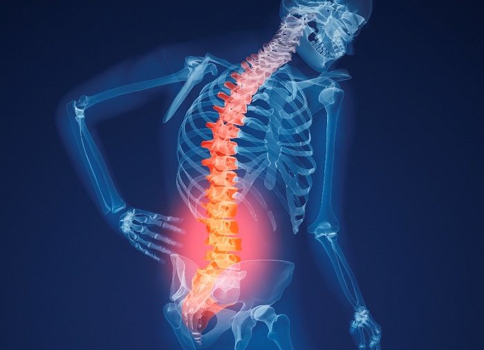 Osteoporosis-Pain