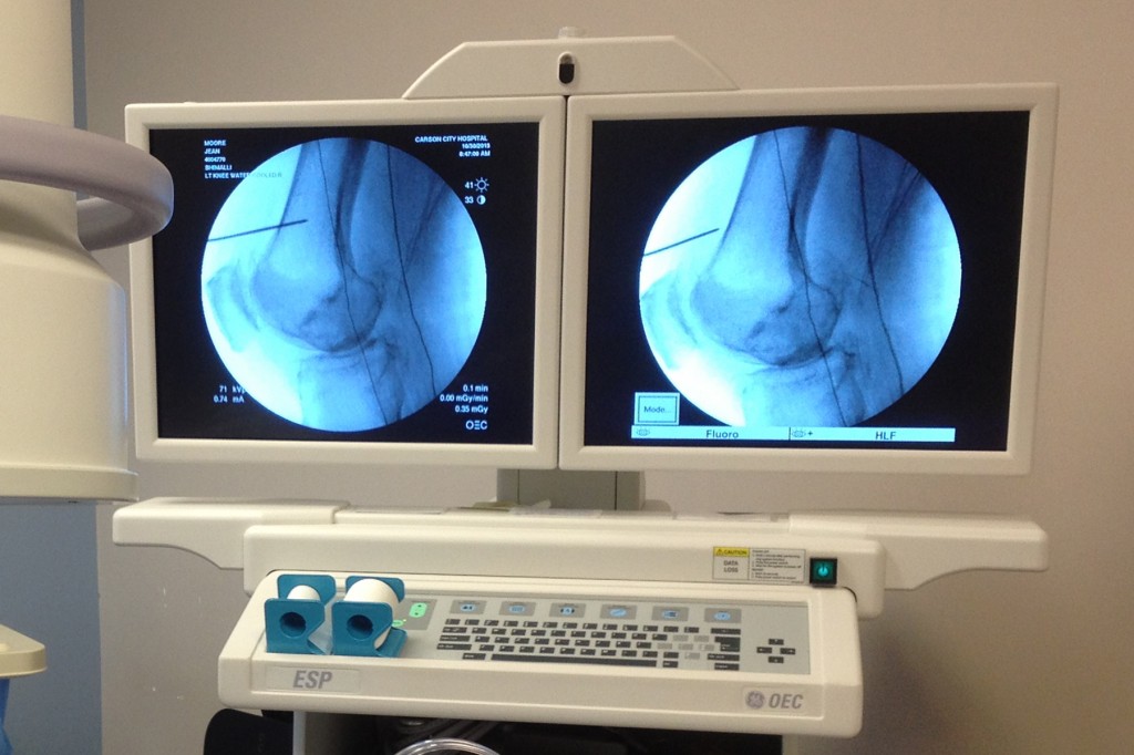 loc-0102-Carson-health-knee-procedure-3-1024x682