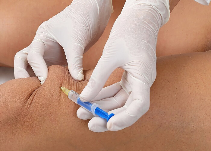 Ozone and PRP, tools for pain specialists