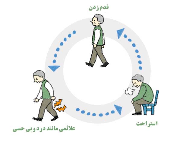علائم تنگی کانال نخاعی