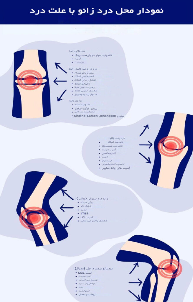 علل درد زانو و کنار زانو
