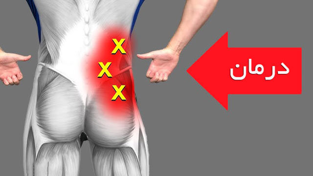 درمان کمر درد پایین سمت راست