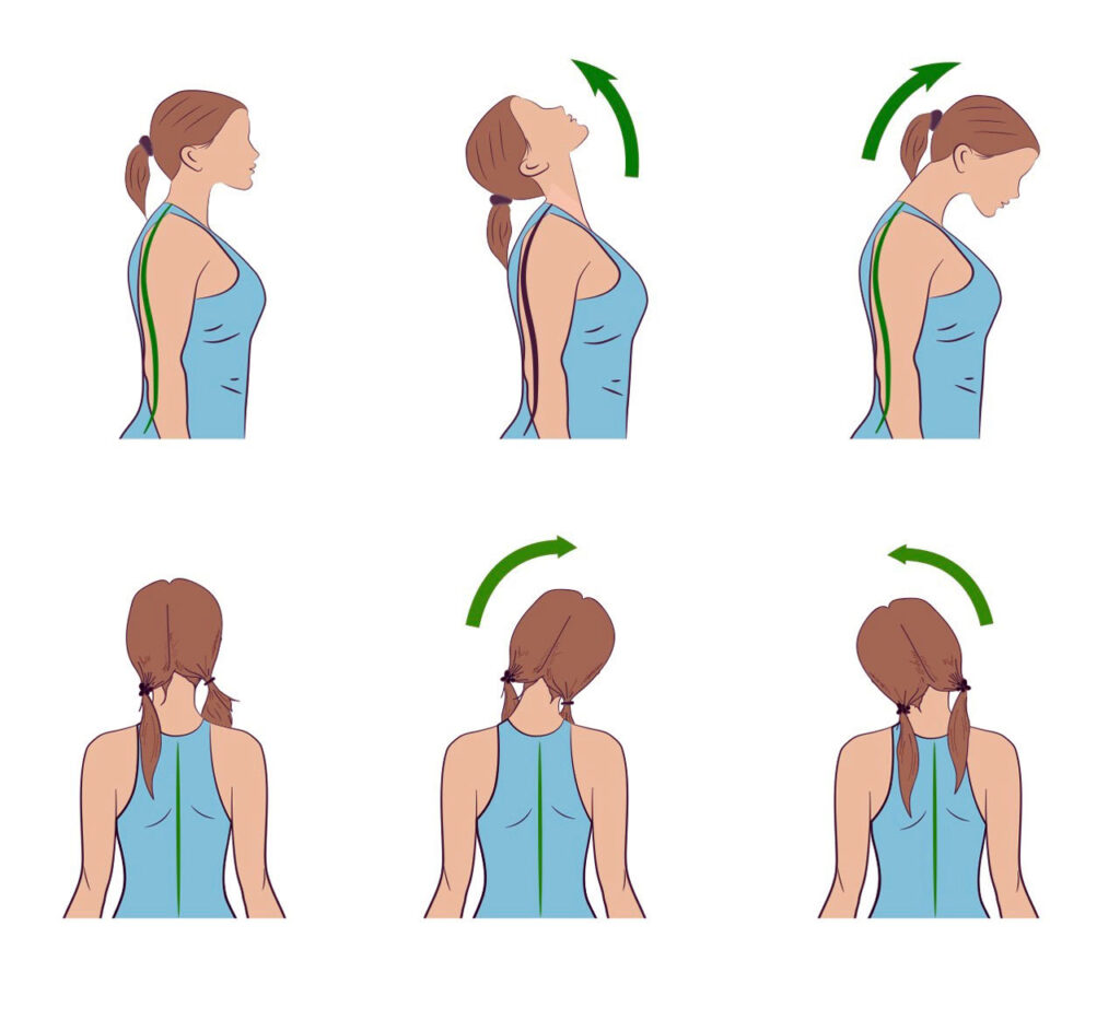  بهبود گردن درد با ورزش