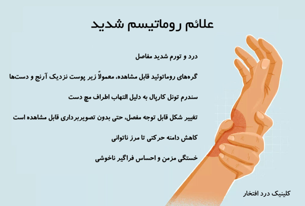 علائم روماتیسم شدید