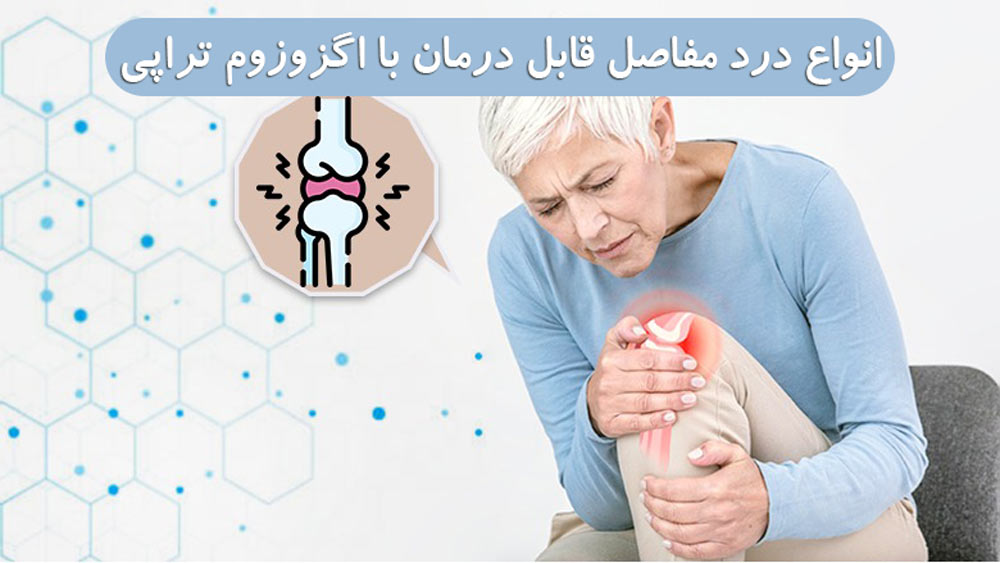کدام انواع درد مفاصل که با اگزوزوم تراپی قابل درمان هستند؟