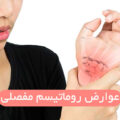 عوارض روماتیسم مفصلی