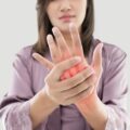 آرتریت زودرس: انواع، علائم و درمان