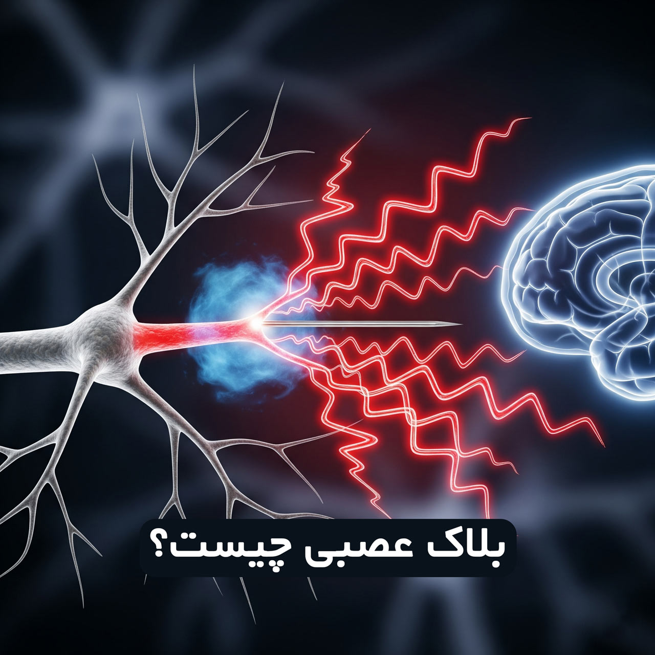 بلاک عصبی چیست؟