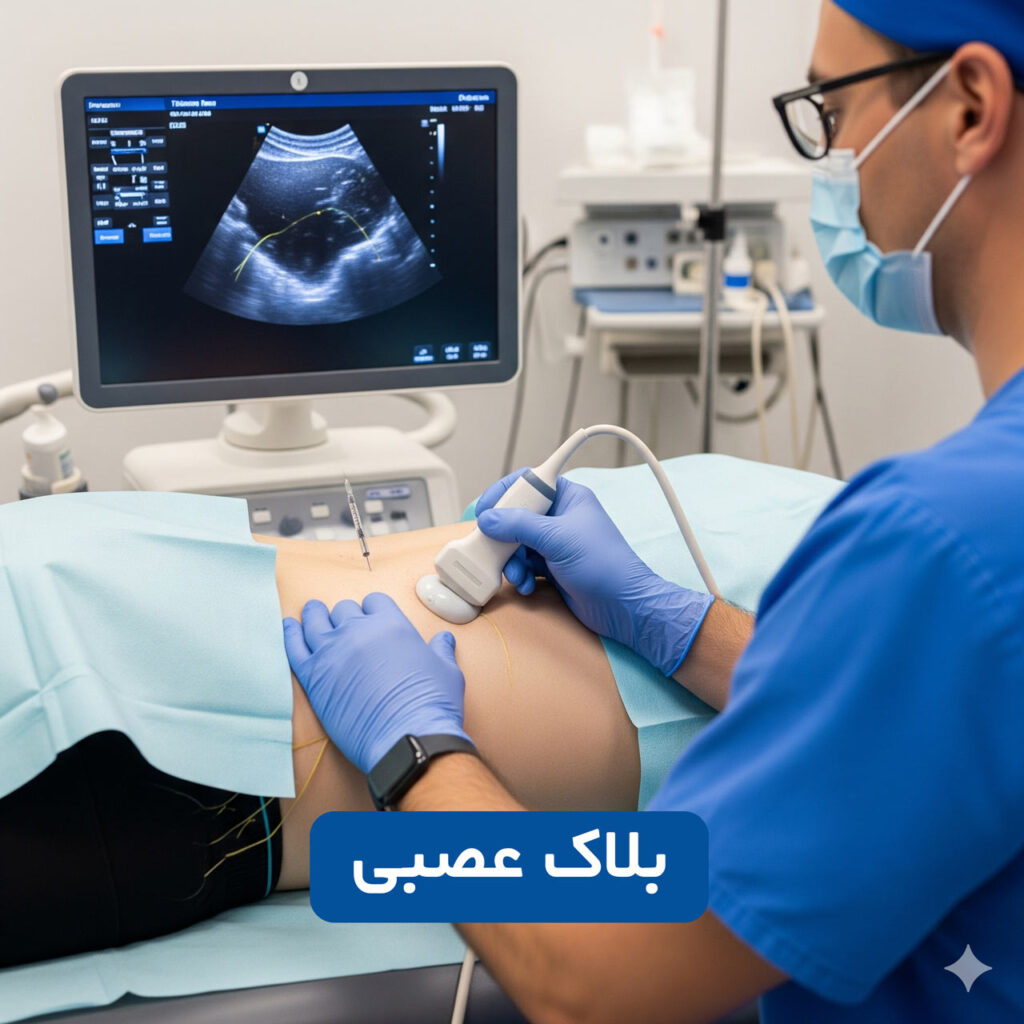بلاک عصبی 