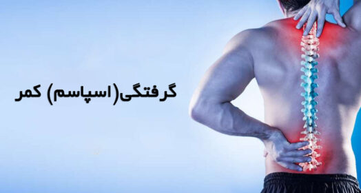 گرفتگی کمر (اسپاسم)