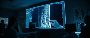 درمان تنگی کانال نخاعی