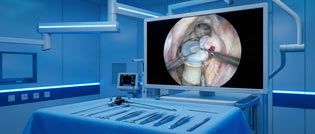 آندوسکوپی دیسک (عمل بسته)