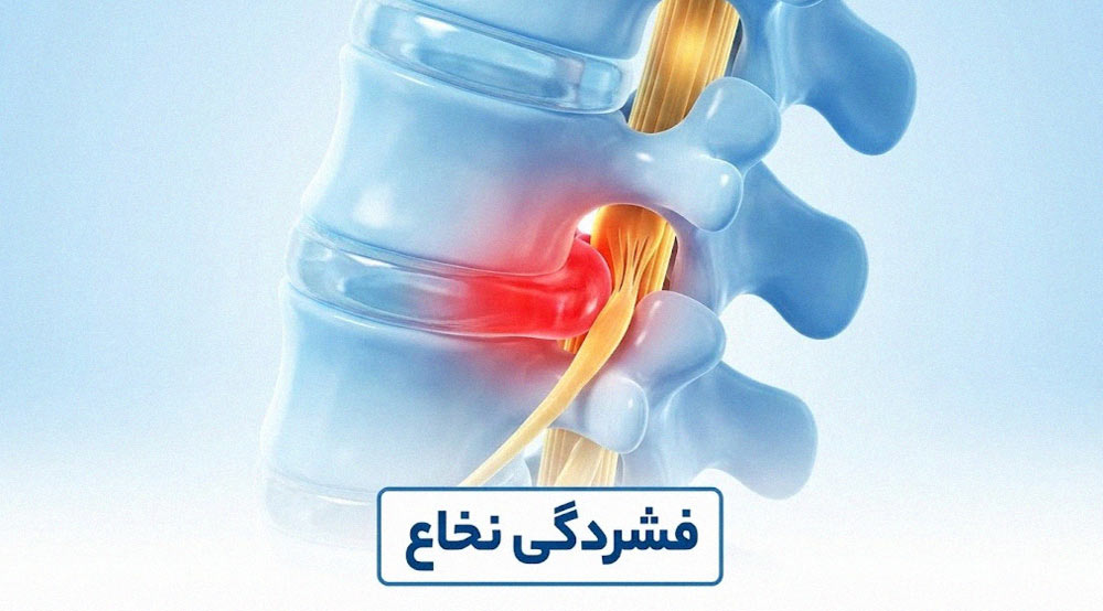 فشردگی نخاع