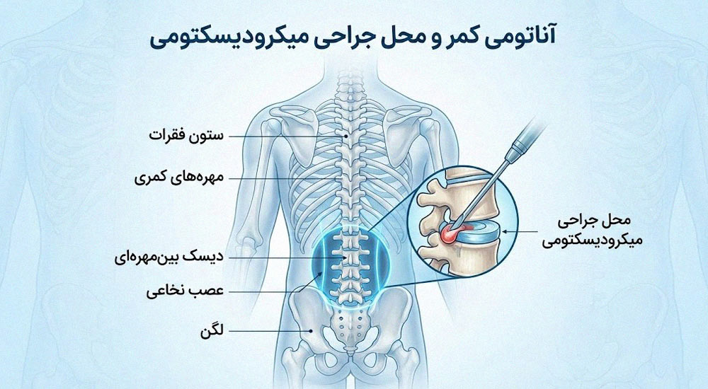 اینفوگرافیک آناتومی کمر و محل جراحی
