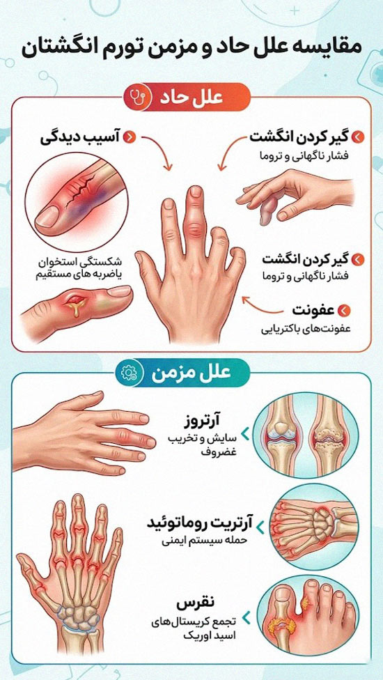 علل حاد و مزمن تورم انگشتان