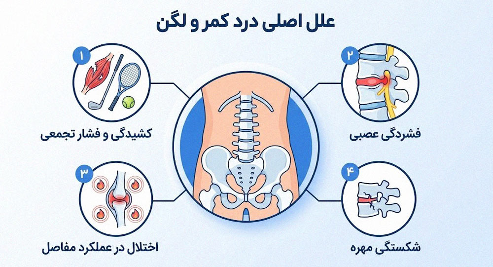 علل درد کمر و لگن