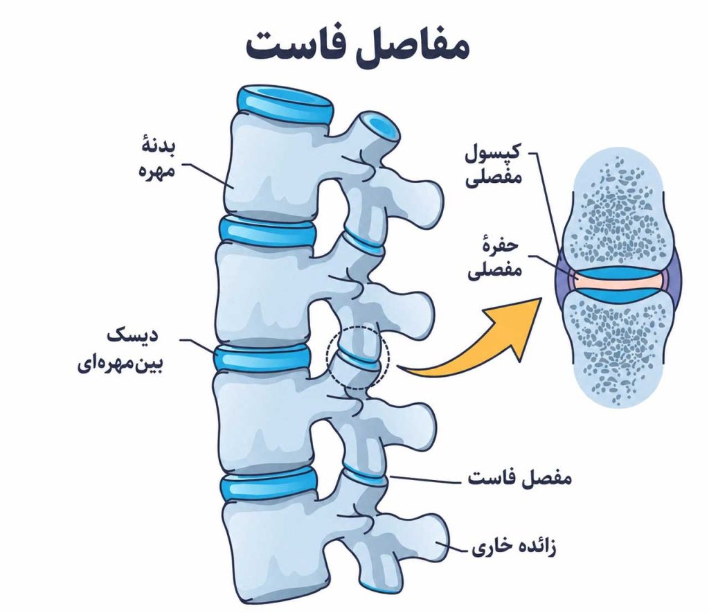 مفصل فاست چیست