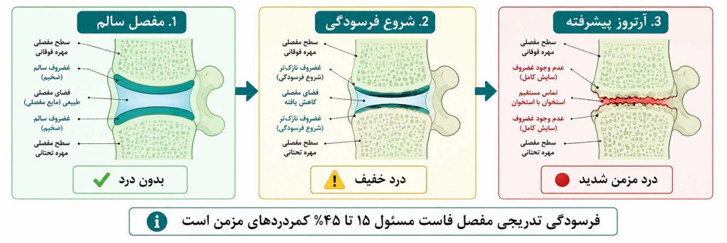 فرایند تخریب مفصل فاست