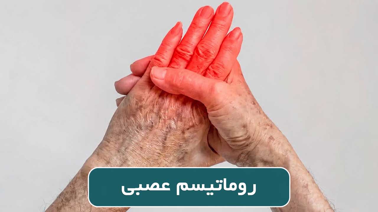 علائم روماتیسم عصبی چیست و چطور درمان میشود؟