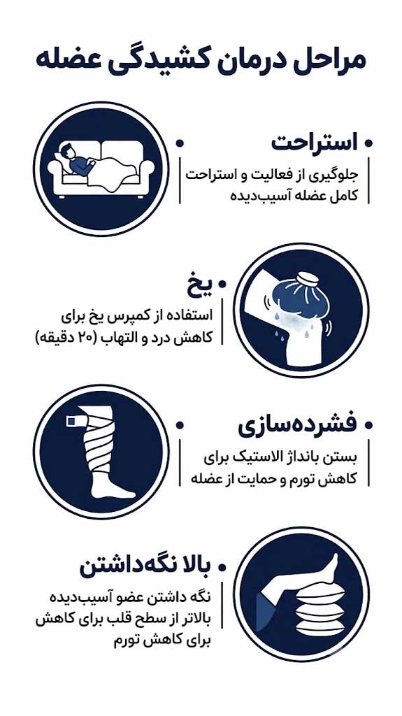 درمان خانگی کشیدگی عضله با روش R.I.C.E