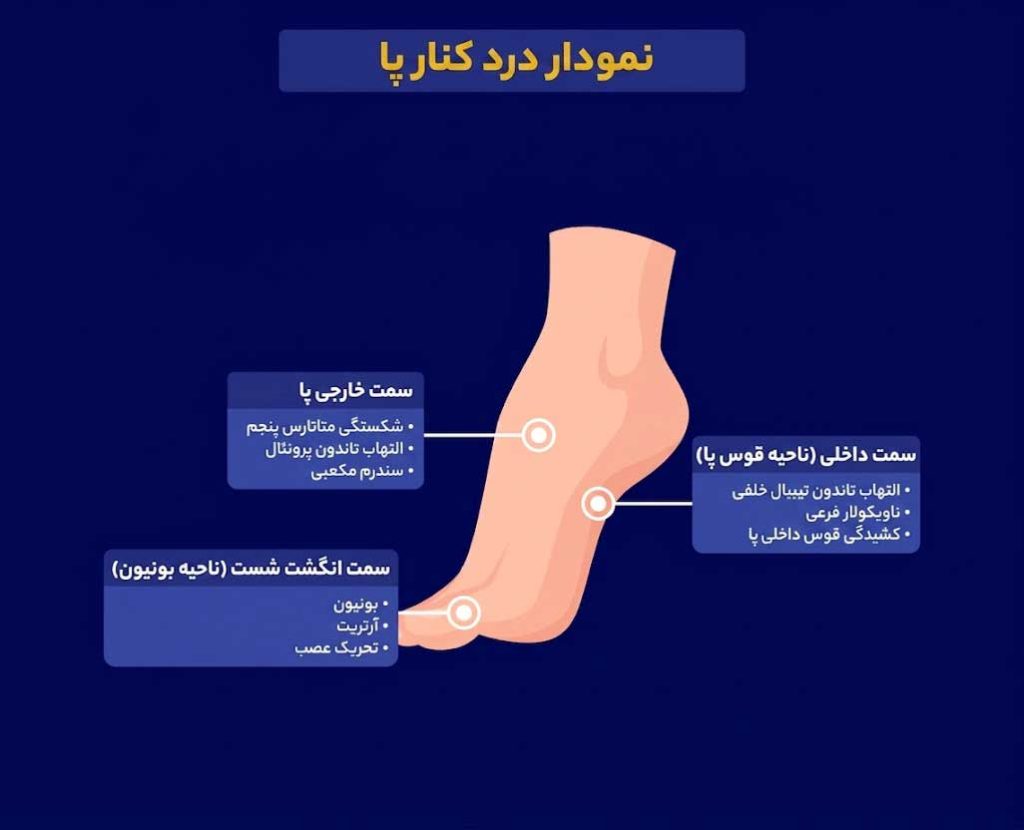 درد کنار پا + جدول