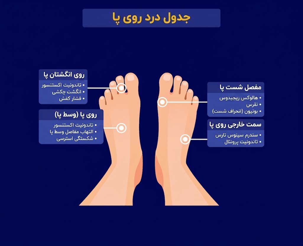 درد روی پا + جدول