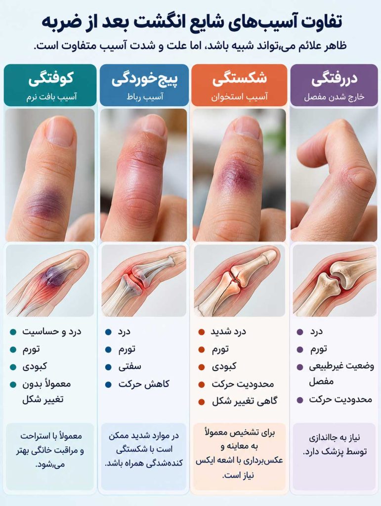 مقایسه کوفتگی، پیچ خوردگی، شکستگی و دررفتگی انگشت دست