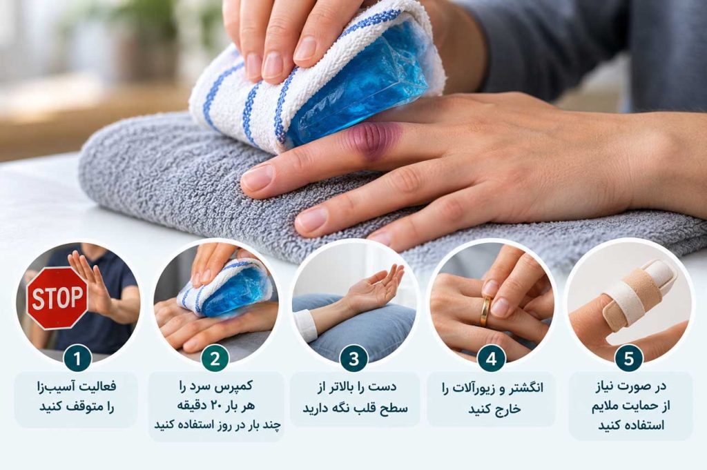 مراقبت خانگی از انگشت متورم بعد از ضربه