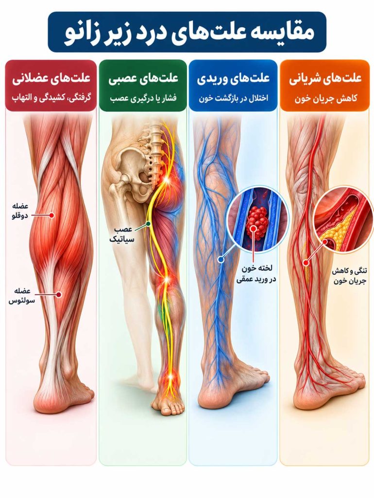 مقایسه علت‌های عضلانی، عصبی و عروقی درد زیر زانو