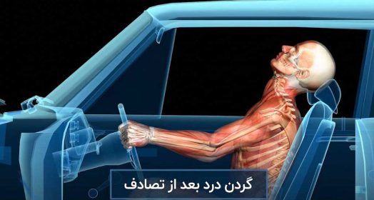 گردن درد بعد تصادف