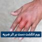 swollen finger after injury 85x85